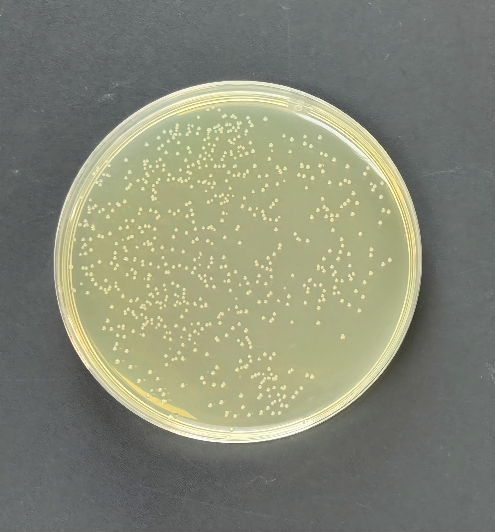 DH5 α (containing YEplac181 plasmid) Escherichia coli-BNCC