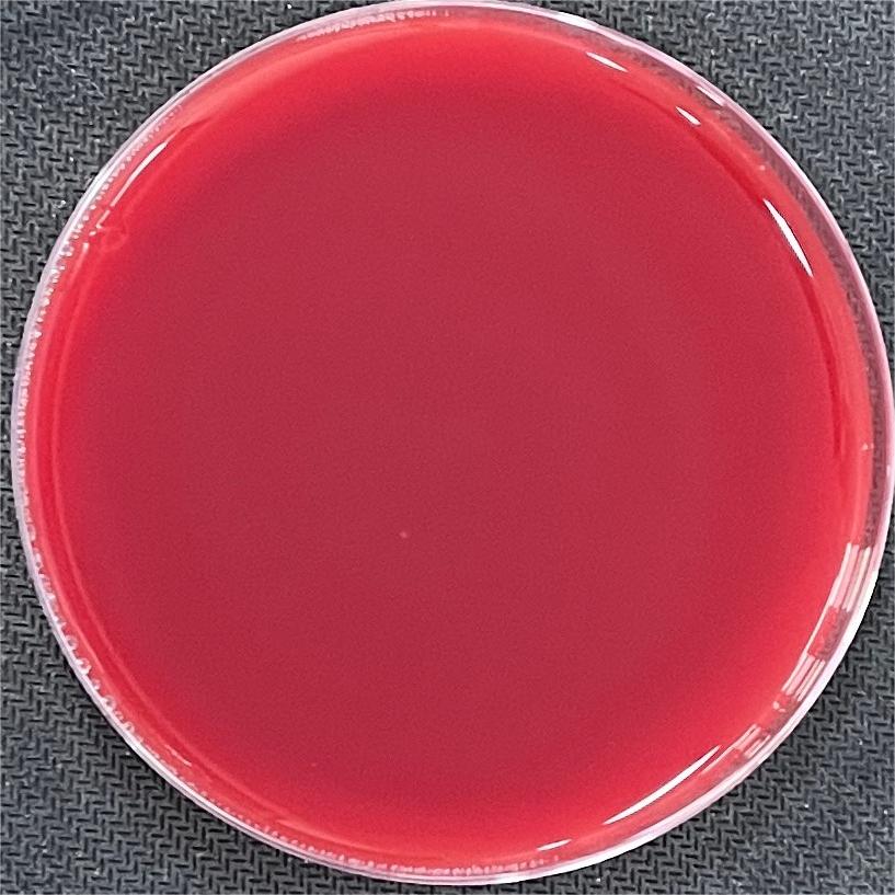 Reference material for Streptococcus agalactiae (Chemical inactivation) (strongly positive)-BNCC