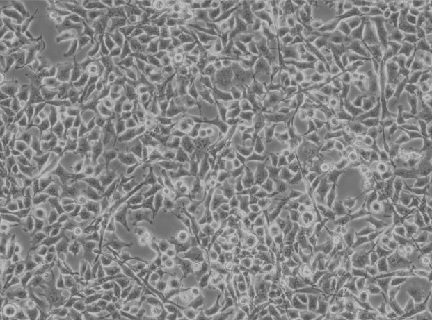 Indoor quality control material for human Coxsackievirus A7 ribonucleic acid liquid-BNCC