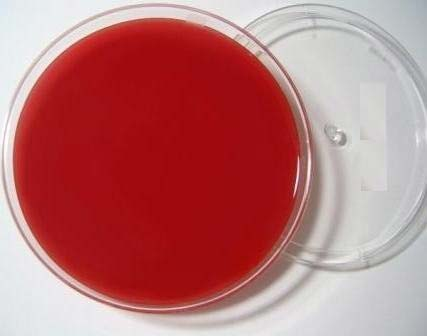 Indoor quality control product for Streptococcus mutans deoxyribonucleic acid liquid-BNCC