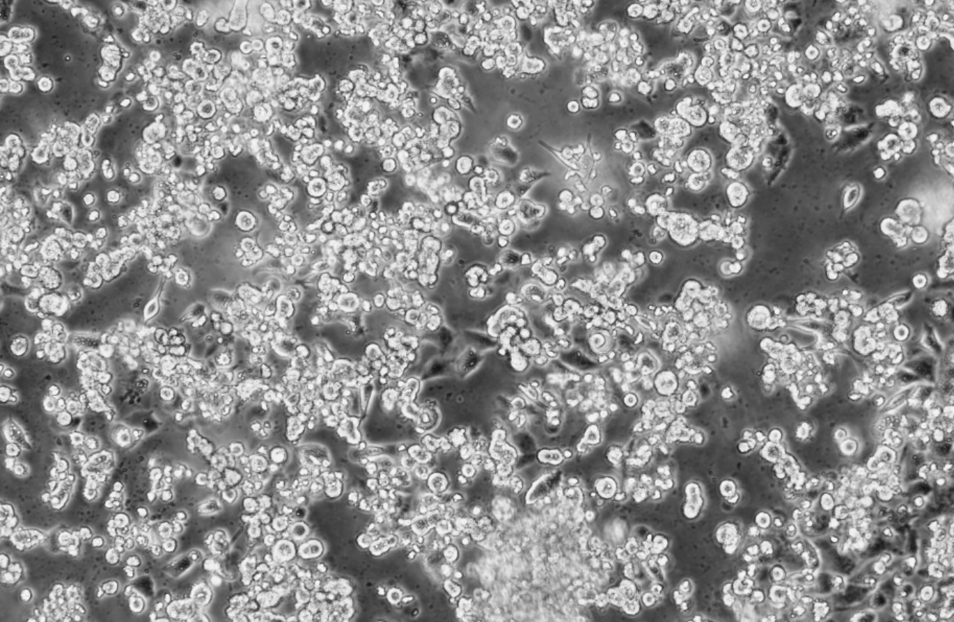 Human Coxsackievirus A10 RNA standard-BNCC